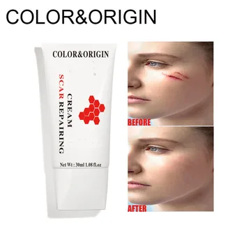 

Color&Origin Scar Removal Cream Stretch Marks Remover Whitening Cream Shrink Pores Blackhead Spots Repairing Acne Treatment Care