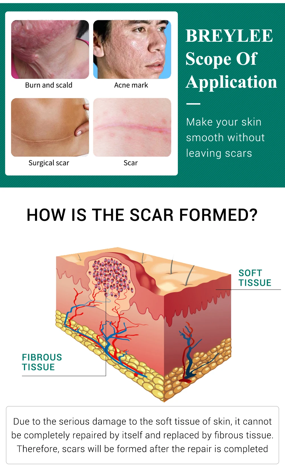 HTB1L545XyHrK1Rjy0Flq6AsaFXaJ