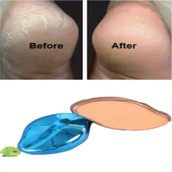 

BellyLady Foot Grinder Exfoliate Foot Hard Dead Skin Pedicure Remover Pedicure Tools