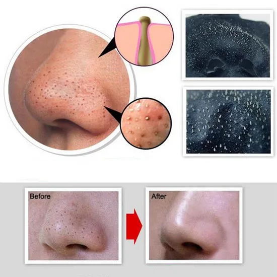 Black Mask Face Blackhead Remover Deep Cleansing Acne Treatment Spot Cleaner Mask For Black Dots Beauty Tool Female Male