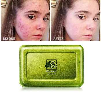 

Green Soap Oil-control Acne Treatment Blackhead Remover Soap Whitening Cleanser Skin Care