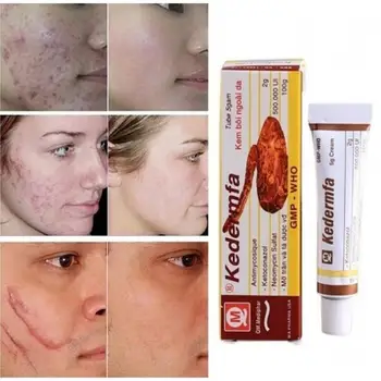 

Vietnam skin cream Original Snake Oil moisturizing hand cream Ance Scar treatment Cream for body face Skin care Massage Cream