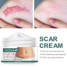 

30g Acne Scar Removal Cream Straight Pimples Face Gel Remove Acne Smoothing Clearing Hydration Care With Skin Of The Body Skins