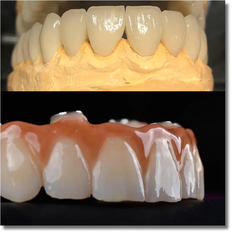 UT extreme 5 шт. 201519 мм sirona/ Cerec эстетика Многослойные ультрапрозрачные высокопрочные