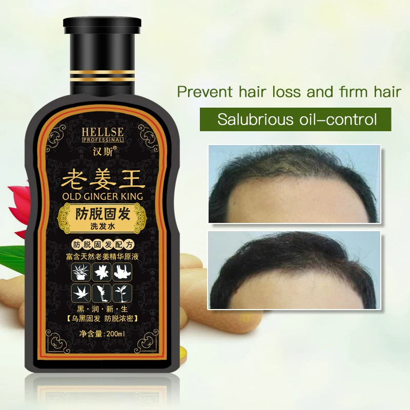 USA in stock 200ml Hans Ginger Shampoo Ginger King Shampoo Antidandruff