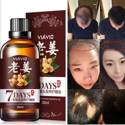 Hot 30ml Magic Fast Hair Growth Dense Regrowth Ginger Serum Oil Anti Loss Treatment Essence Bin Wild Hair Growth Tools Hair Care