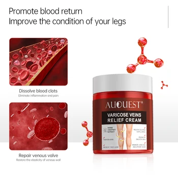 AUQUEST Varicose Veins Relief Cream Vasculitis Phlebitis Spider Pain Relief Ointment Medical Plaster Body Care 80g 5