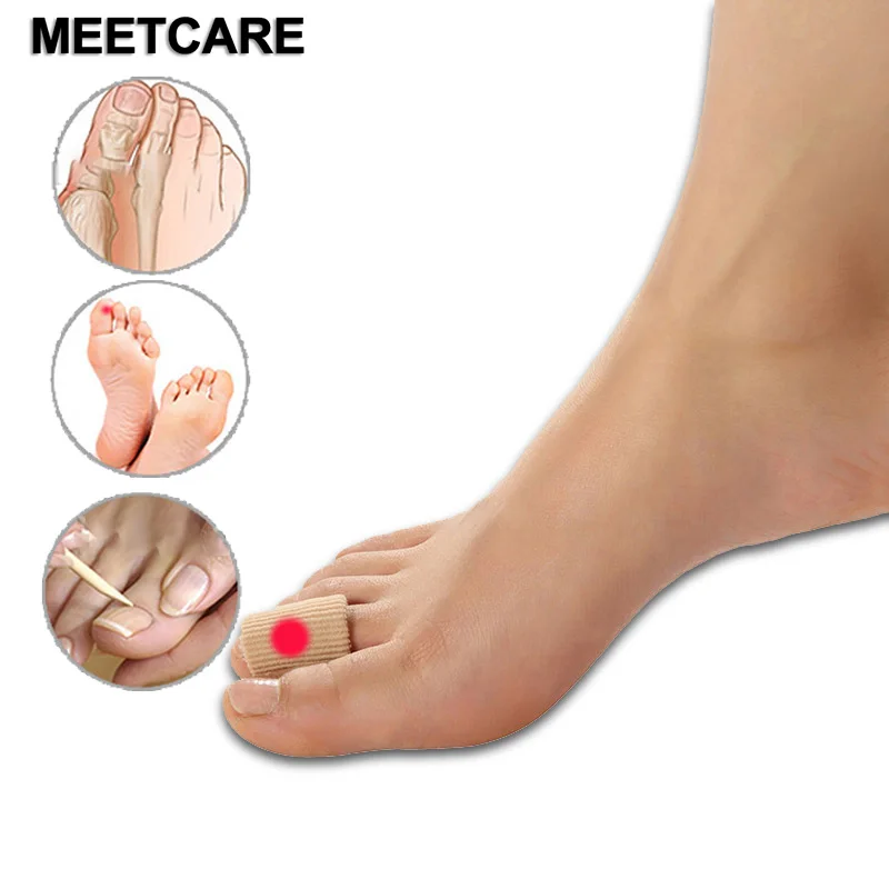cutting corns off toes