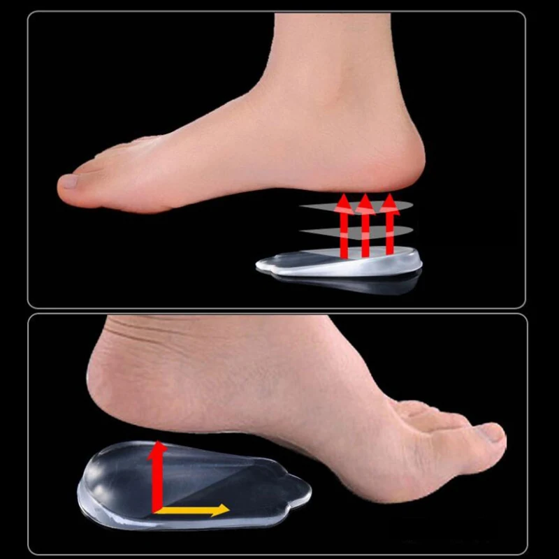 1 пара силиконового типа O тип X стелька для ног Тип для коррекции пятки Подушечка для коррекции пятки инструмент для ухода за ногами