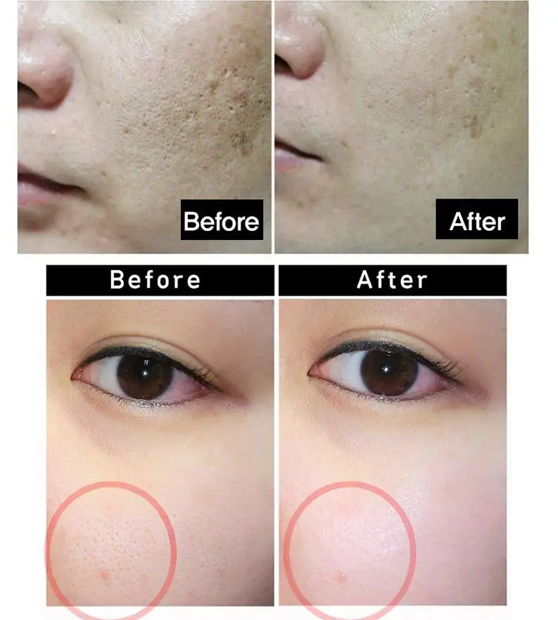 TOSOWOONG Platinum Miracle для сужения пор упаковка 150 г маска для удаления черных точек лица глубокое очищение угрей, уход очищение пор