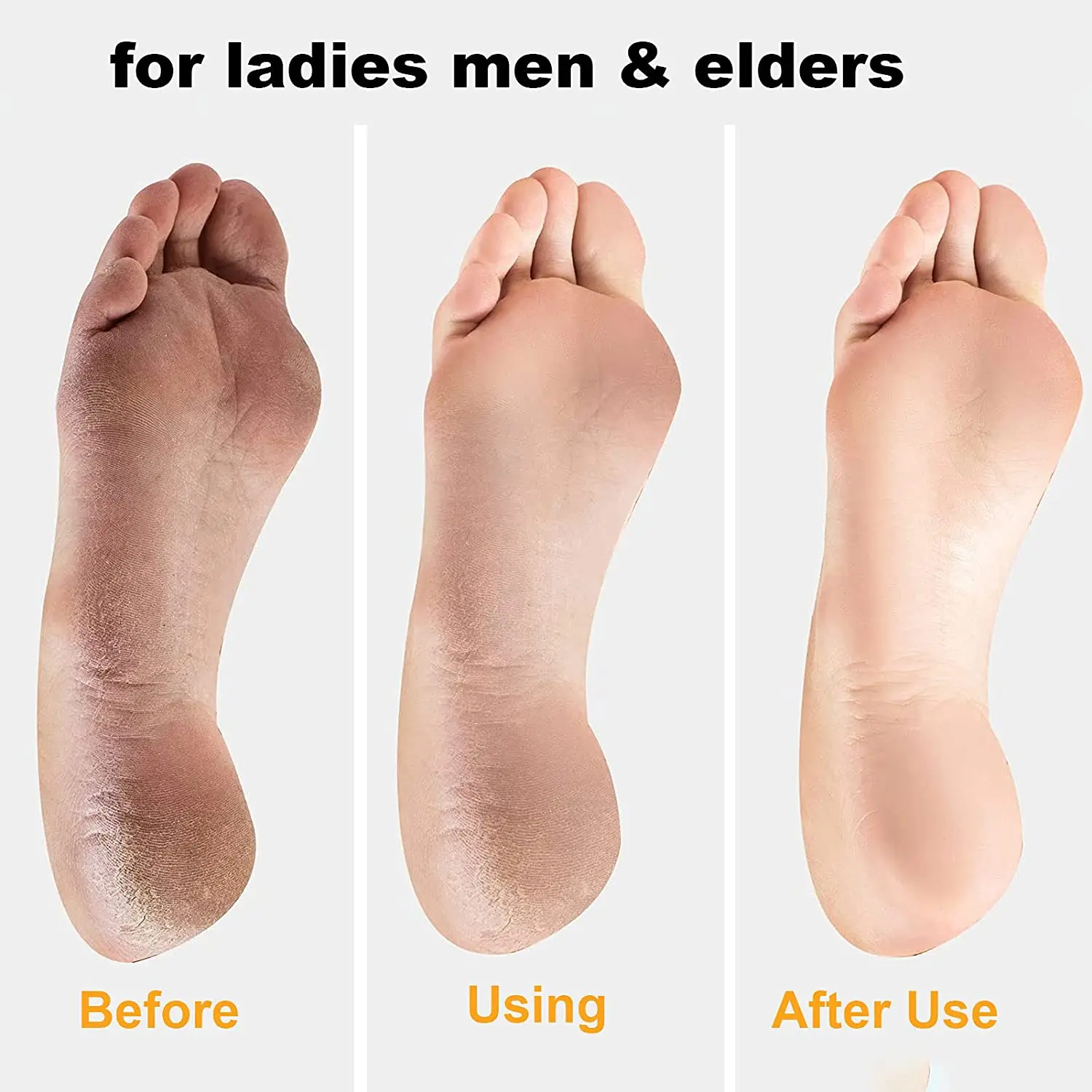 Pedicure Tools Heel Scratcher Files Exfoliating Calluses Brush Stainless Steel Foot Sharpening Double-sided Pedicura