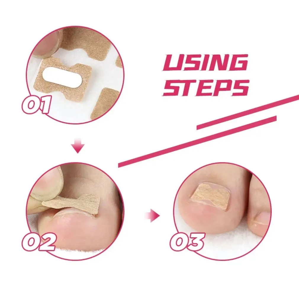 Nail tape stickers Anti-roll nails glue-free toe inlay nails corrector nail patch pull manicure dedicated sticker