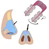 Nose Shaper Nose Up Shaping Machine Lifting Bridge Straightening Nose Clip Face Lift Nose Up Clip Facial Corrector Beauty Tool 4