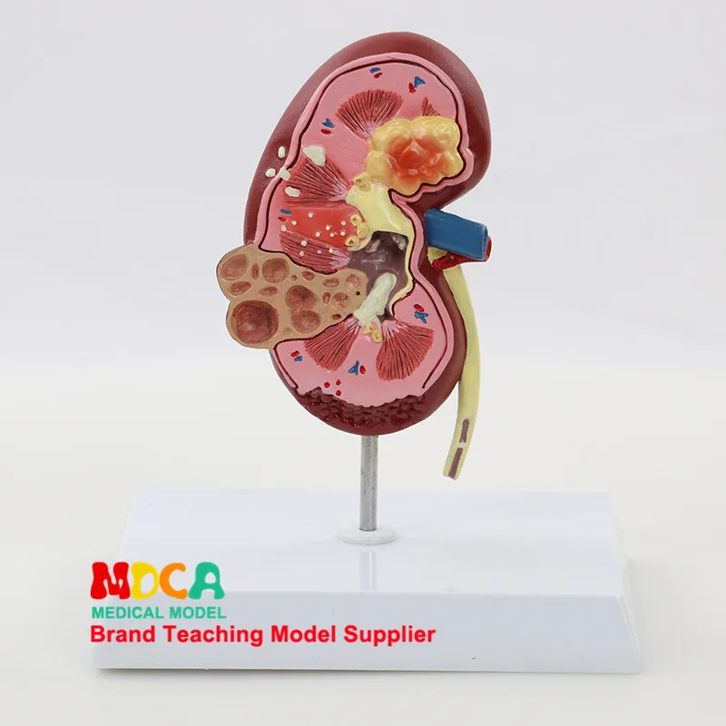 

Human Urinary Section Natural Large Kidney Model Urinary System Renal Structure Medicine Teaching Msz001
