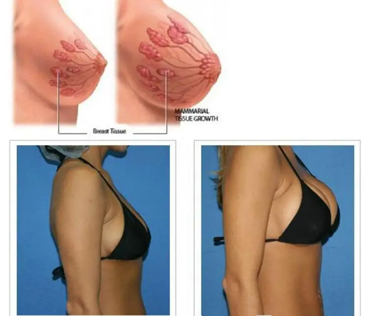 2020 New Arrival !!! Breast Enhancer Vacuum Massage Therapy Enlargement Pump Lifting Bust Cup Massager Body Shaping Beauty Machine