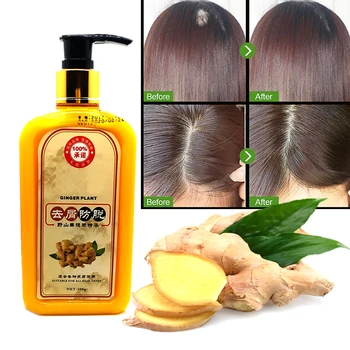 

Hair regeneration shampoo ginger Shampoo Hair regrowth Dense Fast Thicker Shampoo Anti-hair loss Product Hair care styling 300ml