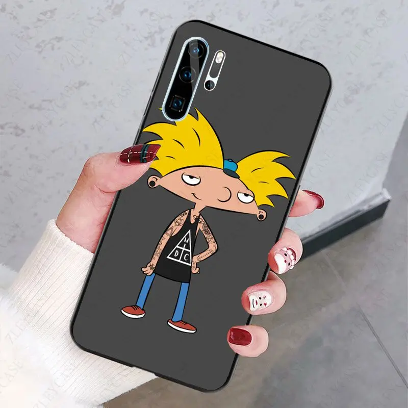 Hey Arnold