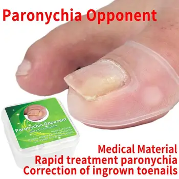 

2Pcs Ingrown Toenail Correction Tools Ingrown Toe Nail Treatment Elastic Patch Sticker Straightening Clip Brace Pedicure Tool