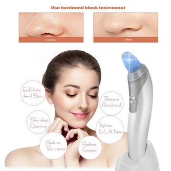 

ABS Skin Care Massage Professional Electronic Facial Pore Cleaner Nose Blackhead Cleansing Acne Remover Comedo Suction Tools