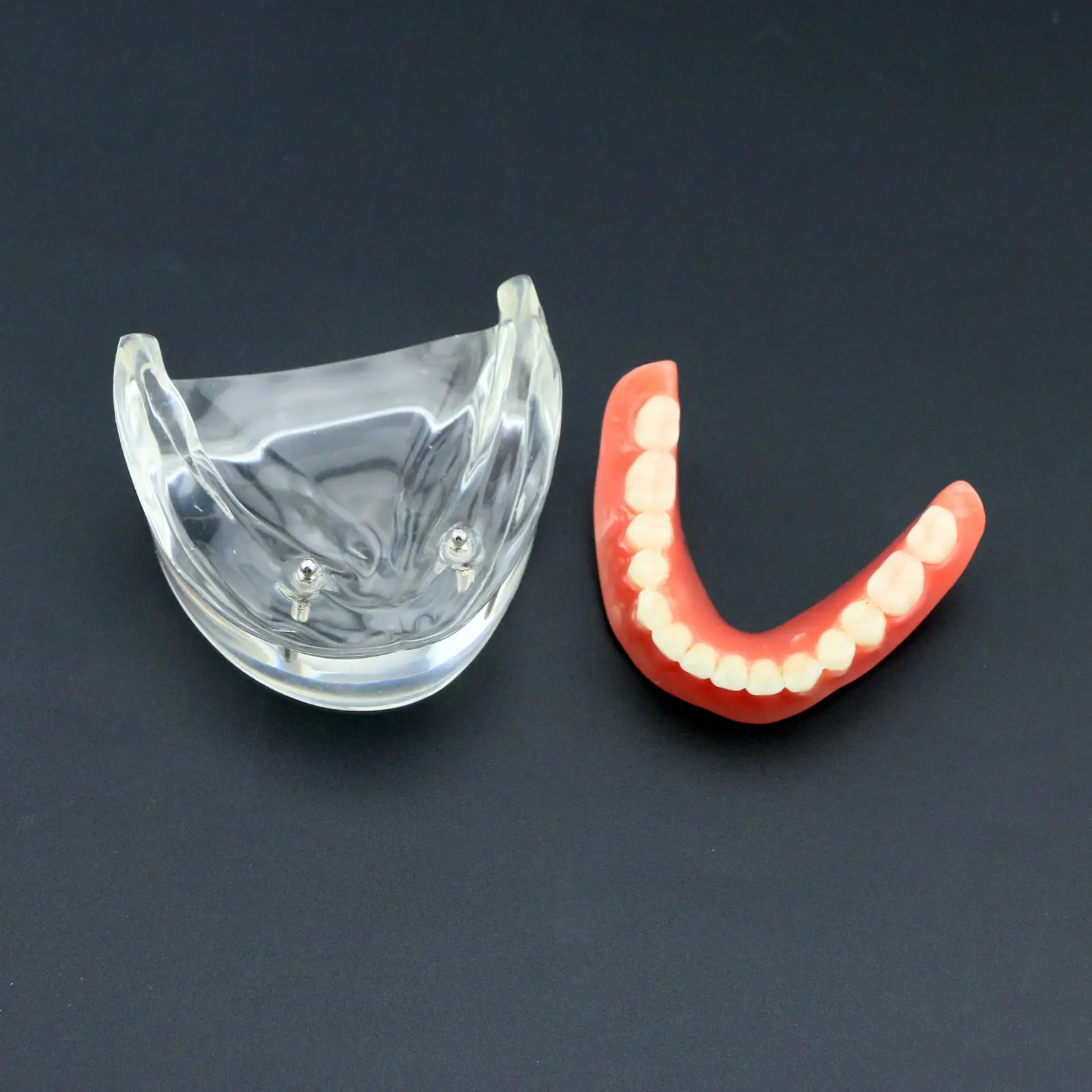 Стоматологическая Overdenture уступает с 2 имплантатами Demo модель исследования модель