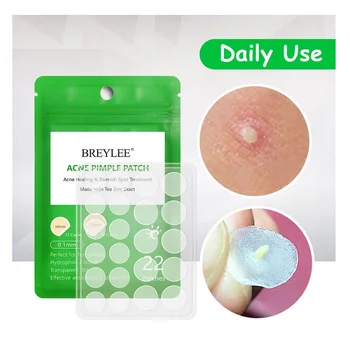

Acne Pimple Patch Acne Pimple Patch Invisible Acne Stickers Effectively Remove Pimples Acne Treatment Mask SkinCare Beauty Tool