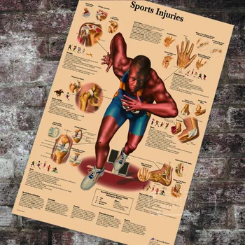 

Anatomy Pathology Anatomical Sports Injuries Chart Classic Canvas Paintings Vintage Wall Posters Stickers Home Decor Gift