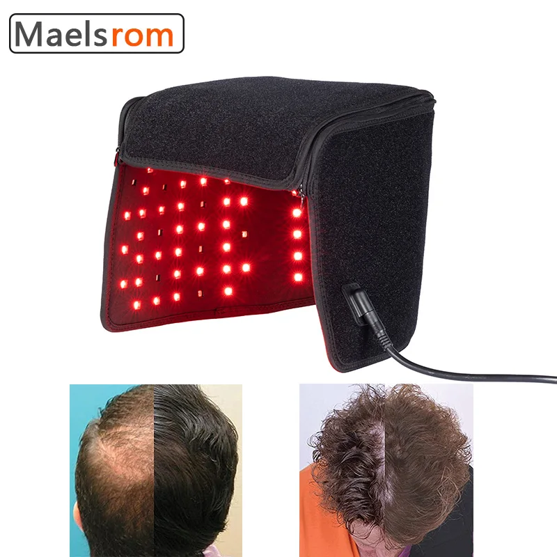 Infrared&Red Light Therapy Cap 215 Lamp Hair Regrowth Helmet Anti-Hair Loss Treatment Hair Follicle Healing Hair Care Head Cover 10pcs plastic helmet clips attachment head light clamps set headlamp hard hat safety cap hook outdoor tools