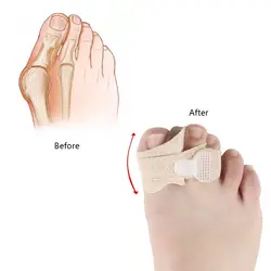 Бюнион шина большой палец Выпрямитель Корректор от боли в ногах исправление шишки на ноге ортопедические поставки педикюр ноги Y1