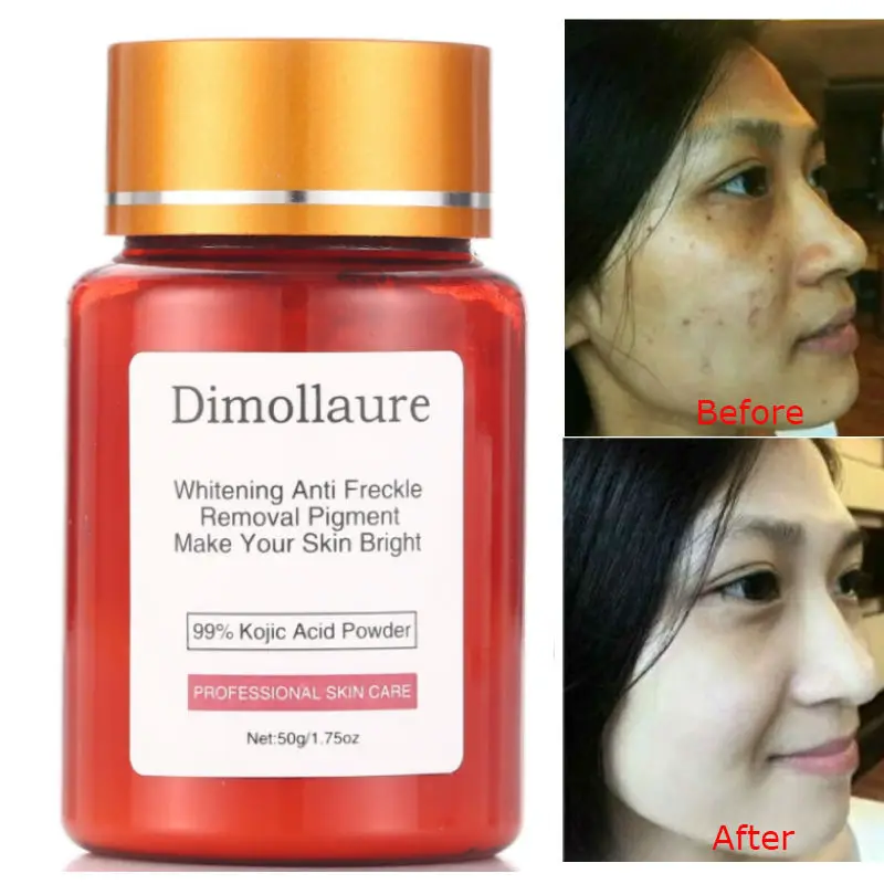 Dimollaure 50 г чистый 99% койевая кислота порошок отбеливающий крем удаление шрамов