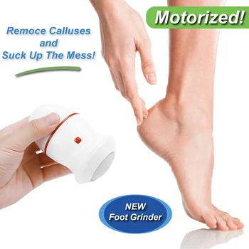 

Electric Foot File Vacuum Callus Remover USB Charging Electric Foot Files Pedicure Cracked Dead Skin Remover Kit Feet Care