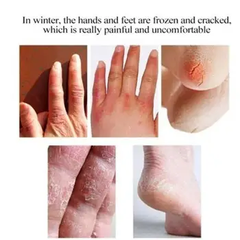 

20g Horse Oil Repair Cream Anti-Aging Day Cream Horse Oil Anti Moisturizing Skin Wrinkle Cream Care Whitening Ointment N3K8