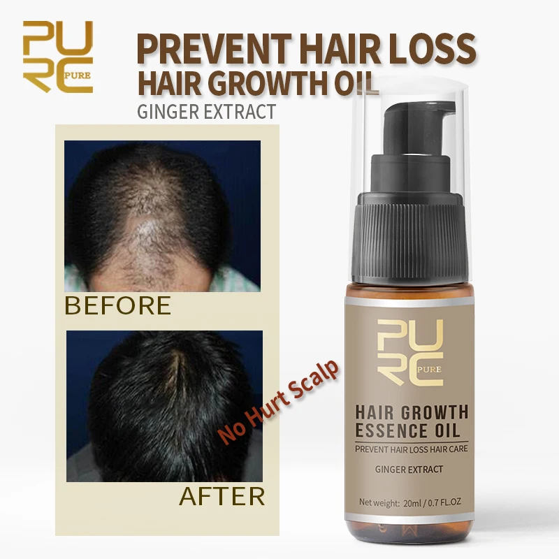 PURC масло эссенчел для быстрого роста волос, предотвращающее выпадение волос, 20 мл, волшебная маска для ухода за волосами