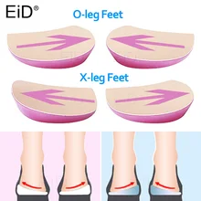 EiD 2 шт XO ноги ортопедическая обувь колодки ортопедические стельки для плоскостопия в пределах восьми пальцев ног для ног, ортопедический Varus правильные ортопедические колодки для обуви