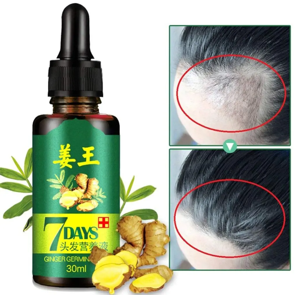Имбирь Germinal сыворотка питательная эссенция масло естественное выпадение волос лечение эффективный быстрый рост Уход за волосами 30 мл
