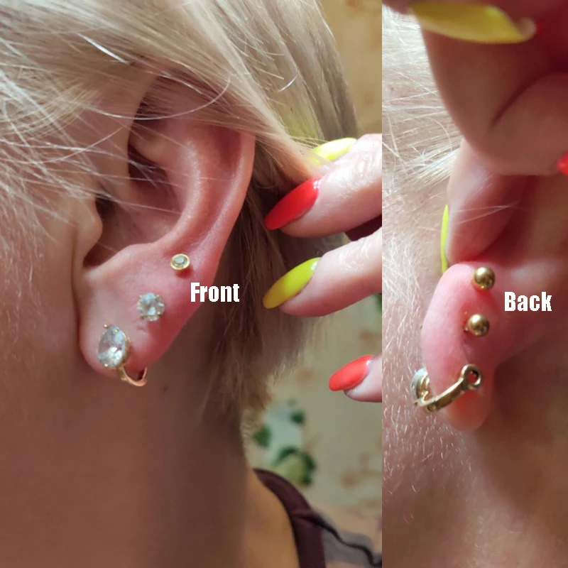 Sterile Surgical Steel Ear Stud with Secure Ball Closure