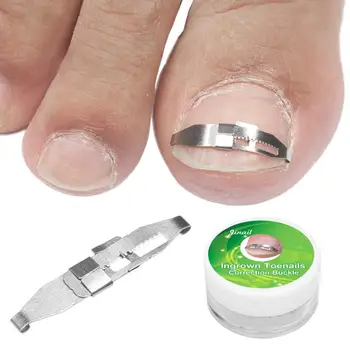 

3Pcs /Set Ingrown Toenail Correction Line Fixer Pedicure Repair Embedded Toenail Correction Device Foot Care Tool
