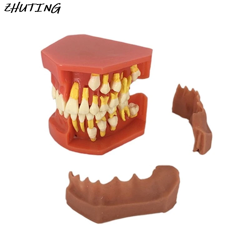 

Dental Children Removable Deciduous Teeth Model Permanent Tooth Alternative Display Studying Teaching Tool