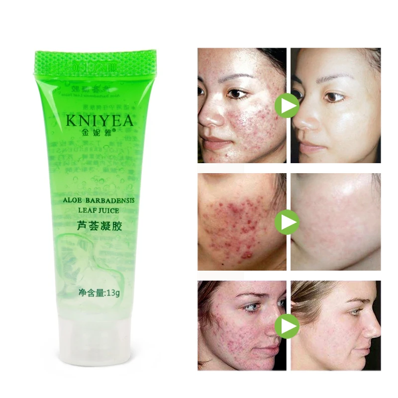 

1pcs Natural Aloe Vera Gel Face Moisturizing Smoothing Cream Acne Remover Sunscreen Acne Treatment Facial Skin Care Base Primer