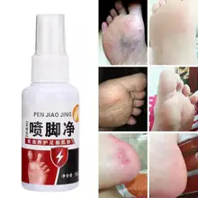 Освежающий аэрозоль для ног питательный зуд блистер лечение бактерий аэрозоль для ног инструмент для ухода за кожей 50 мл для ухода за ногами
