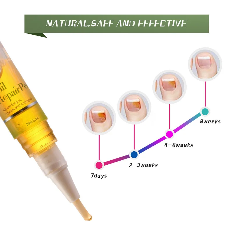 Масло для ногтей, ручка для ремонта, стерилизация ногтей, грибковое Лечение ногтей, обработка ногтей, грибок, ручка с агентом, Уход за ногтями, уход за кожей, TSML2