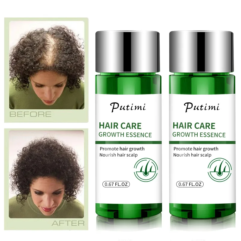 Cut Price Serum Hair-Care Anti-Hair-Loss-Treatment Growing Restoration Fast 20ml Oils Dense-Extract 1zWO9VN8a