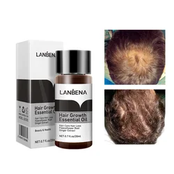 LANBENA Fast Powerful Hair Growth Essence Products Essential Oil Treatment Preventing Hair Loss Hair Care Andrea 20ml