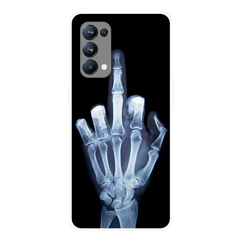Soft Silicone Shockproof Phone Case