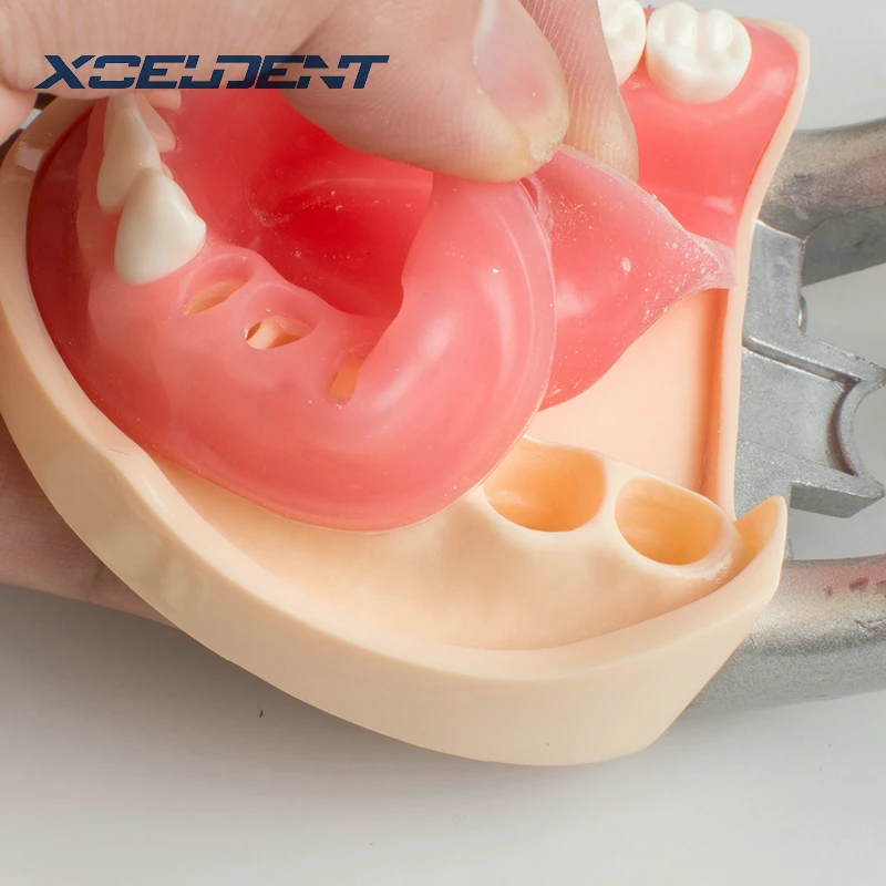 Модель зубов Стоматологическая универсальная пластина съемная модель зуба с DP артикулятором для стоматологов тренирование стоматологических студентов демонстрация