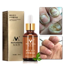 Грибковое Лечение ногтей, уход за ногами, эссенция, отбеливание ногтей и ног, удаление грибка ногтей, гель для ногтей