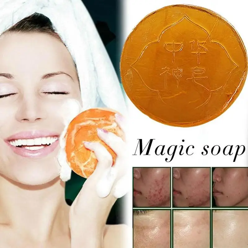 Волшебное мыло контроль масла мыло для тела отшелушивающий отбеливающий натуральный душ для ванны Очищение акне волшебное мыло ручной работы