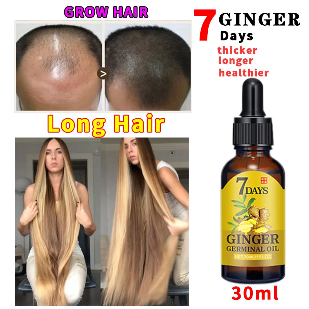 Essence-Oil Hair-Loss-Treatement Natural-Ginger Fast-Growth Serum Conditioners Plant