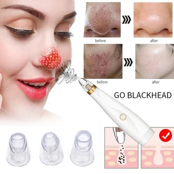 

3 Treatment Heads Pores Cleaner Face Cleansing Instrument Magic Effective Acne Removing Apparatus Beauty Supply Massager
