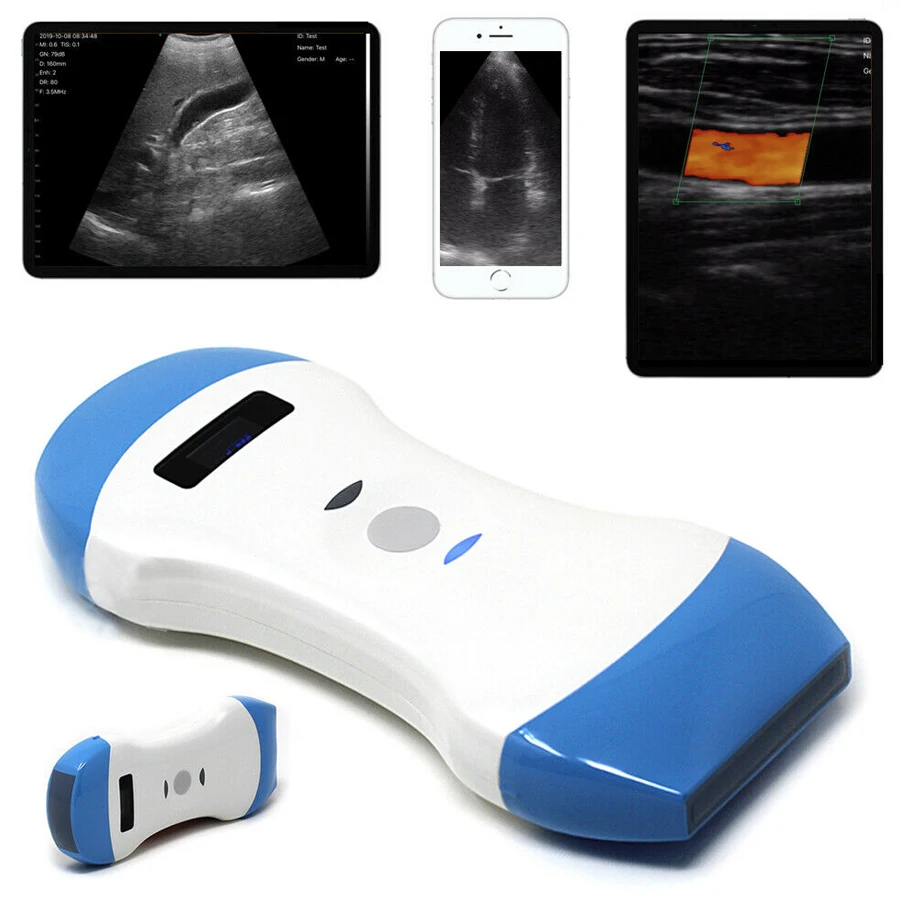 

Wireless 3 In 1 Pocket Ultrasound Cardiac Color Doppler Phased Array Probe with battery charger 128 elements by DHL free ship