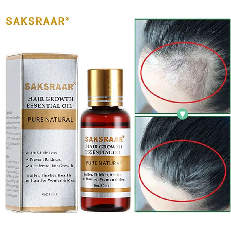 Hair Care Hair Growth Essential Oils Essence Grow Hair Fluid Prevent Hair Loss Health Care Beauty Dense Hair Growth Serum